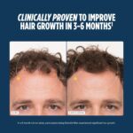 Nutrafol Men Hair Growth Supplements, Ages 18-49, 2-Month Bundle - Image 10