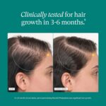 Nutrafol Postpartum Hair Growth Supplements, Clinically Tested for Visibly Thicker Hair - Image 10
